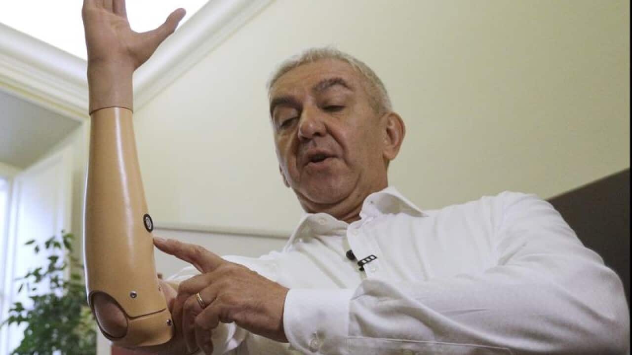 Marco Zambelli shows his prosthetic hand