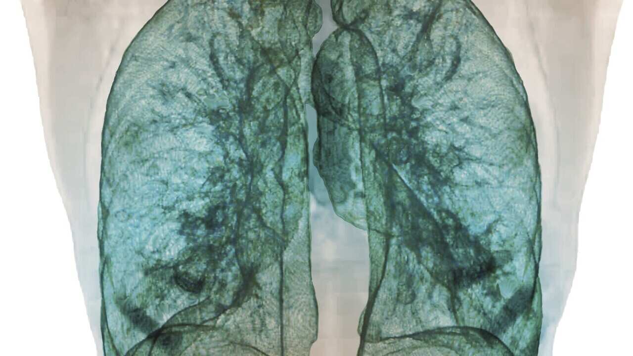 Healthy lungs, 3D CT scan