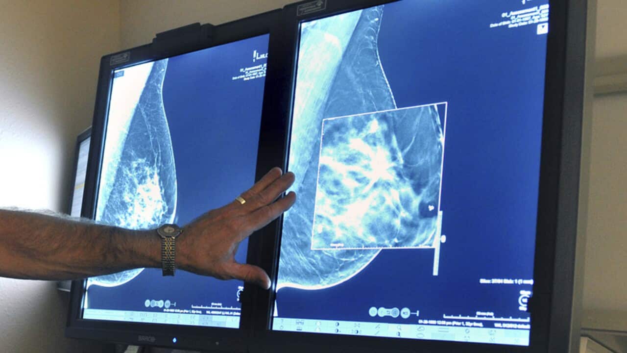 A radiologist studies a mammogram