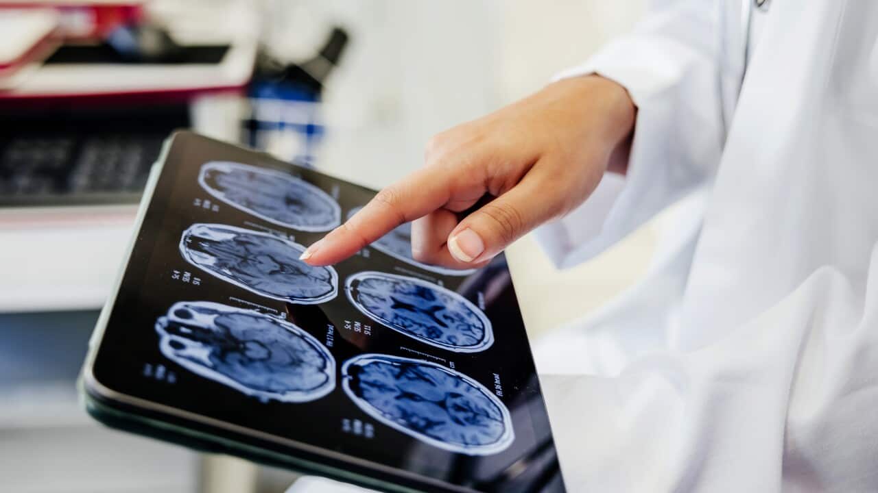 Close-up Shot of a Doctor's Hand Pointing on Brain Scan Images on Digital Tablet