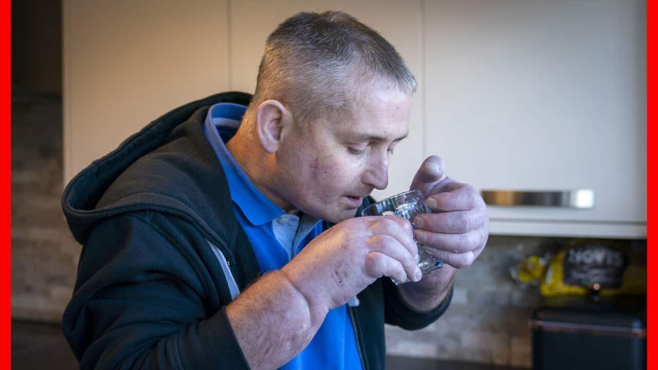 Double hand transplant patient
