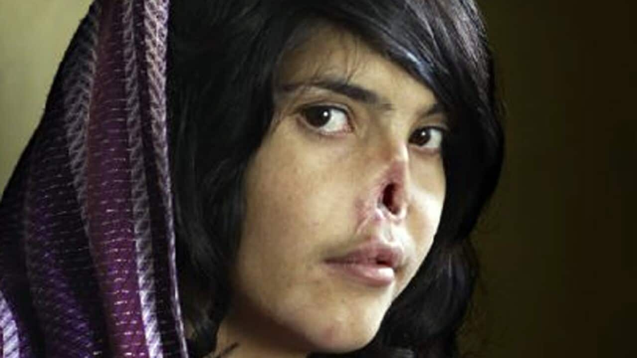 world_press_photo_winner_1102_L_757526556