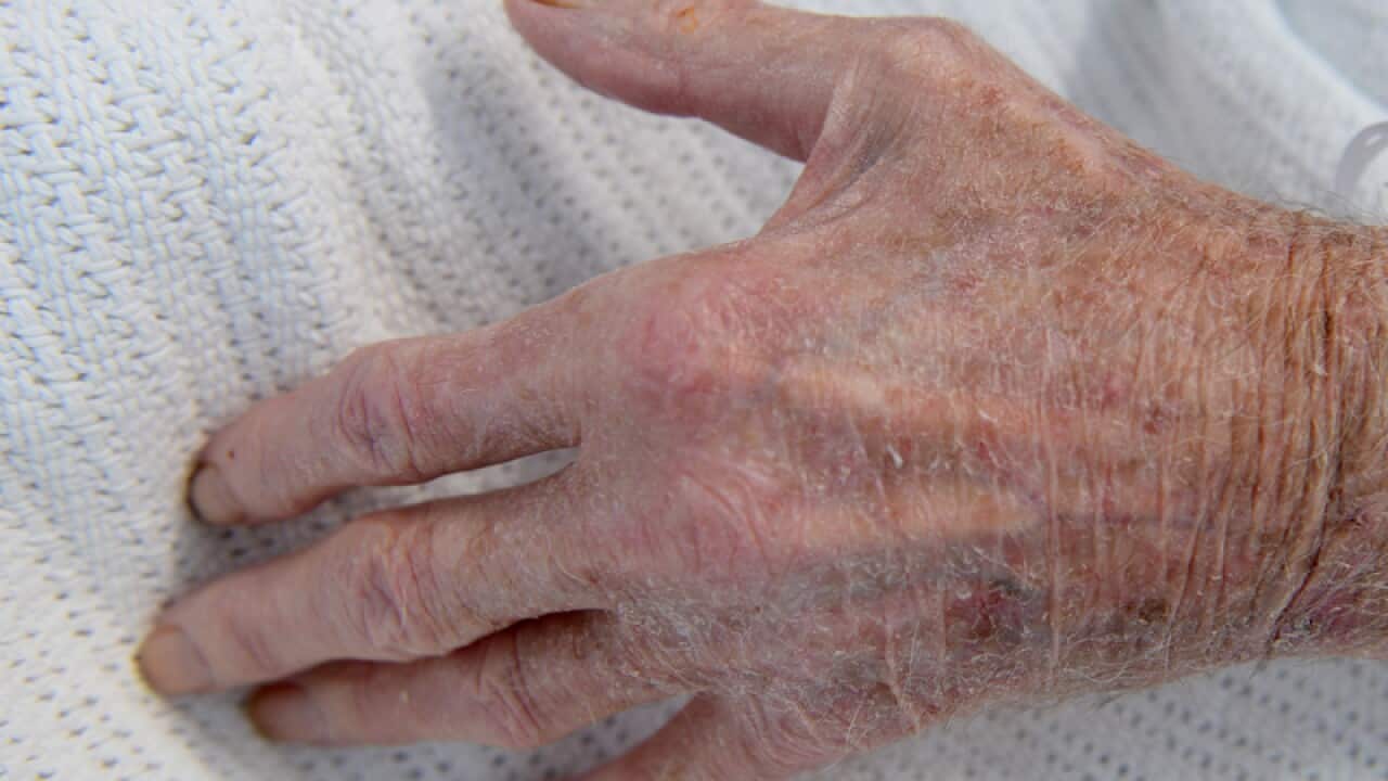An elderly patient's hand