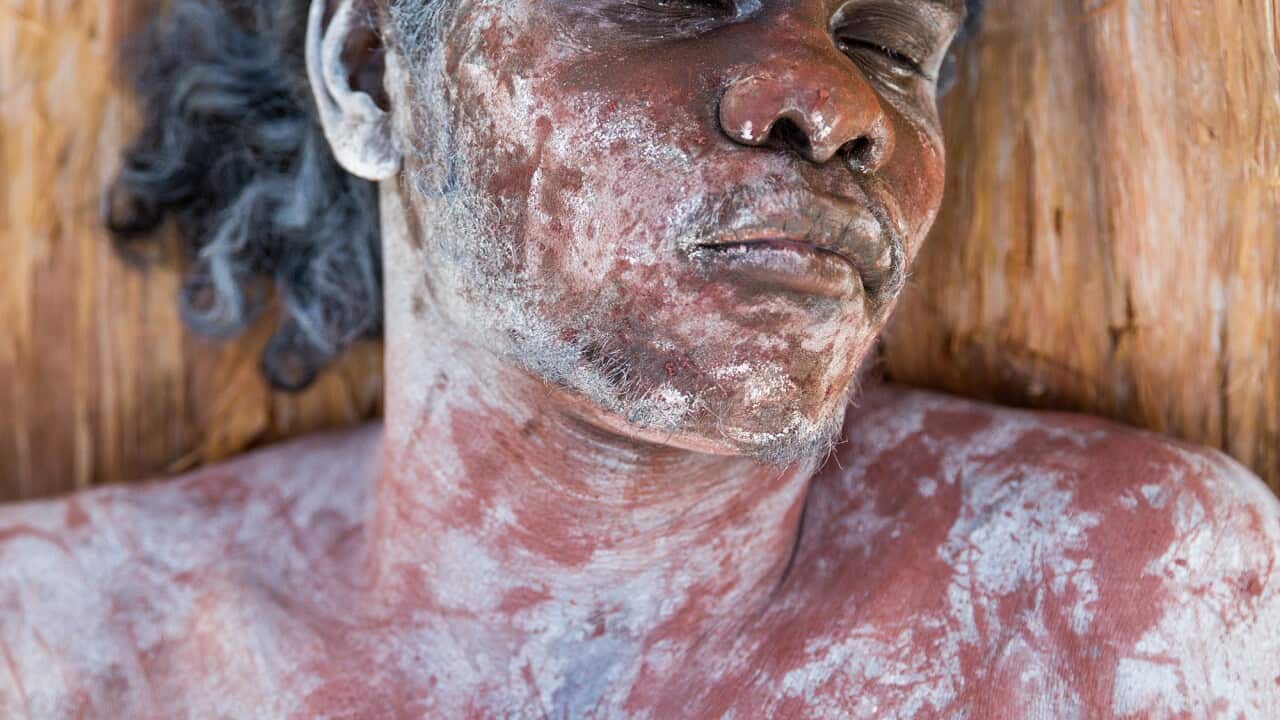 'Wurray'. Image: Milingimbi Art and Culture Aboriginal Corporation