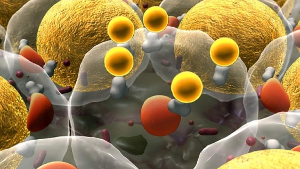 Image for read more article ''