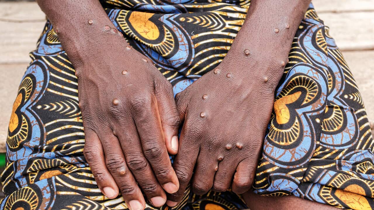 a woman's hands with skin lesions