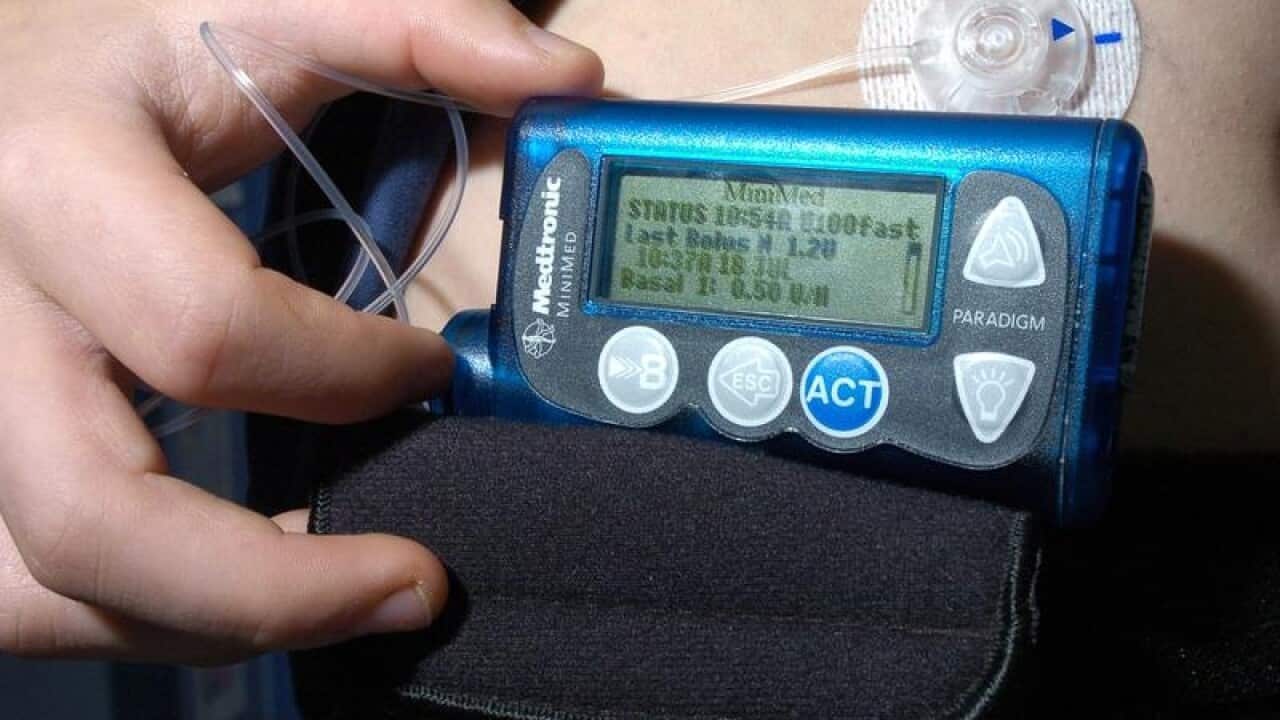 A file image of an insulin pump on a child at a Sydney hospital.
