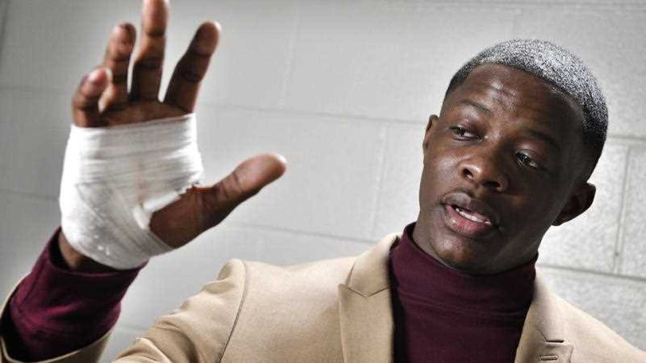 James Shaw Jr., shows his hand that was injured when he disarmed a shooter inside a Waffle House on Sunday, April 22, 2018, in Nashville, Tenn.