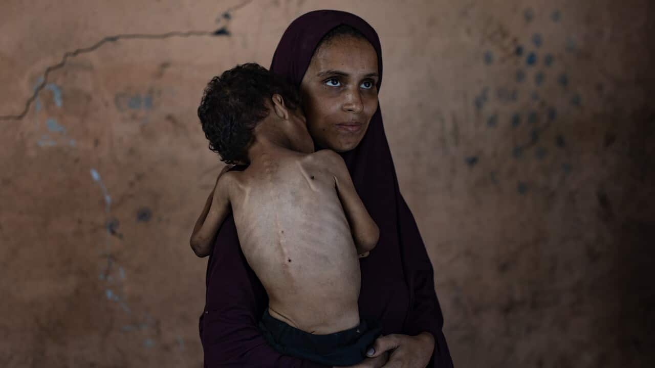 Two year old Yazan Abu Foul with his mother Naima