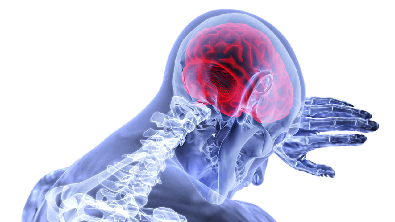 Stroke - Pixabay
