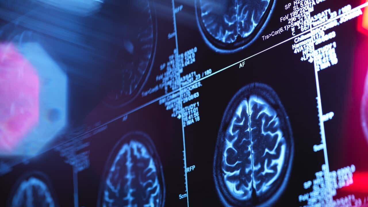 Human brain scan in a neurology clinic.