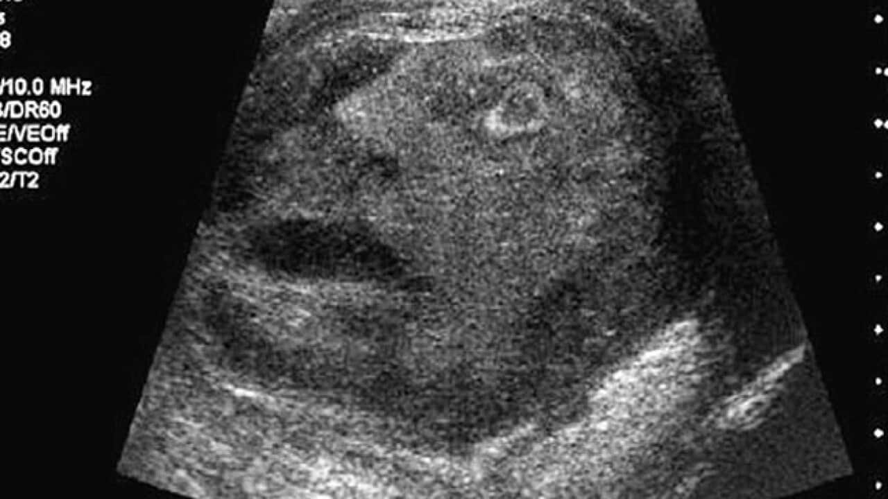 testicle_face_b_111103_journalofurology_1562239581