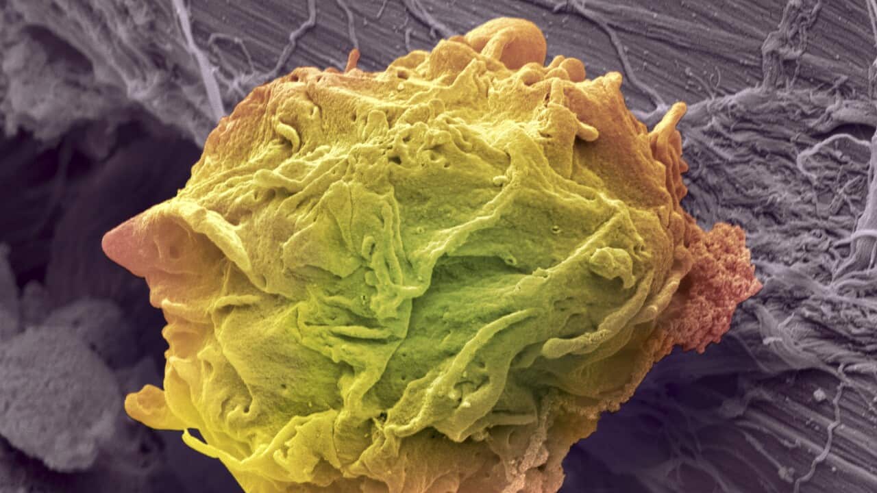 Image for read more article 'READ MORE'