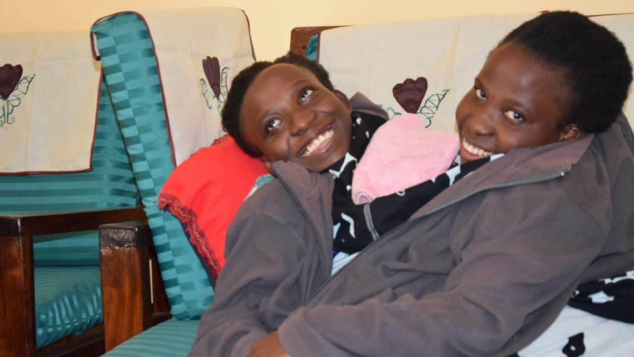 Tanzanias Celebrated Conjoined Twins Die At Age 21 Sbs News 1594