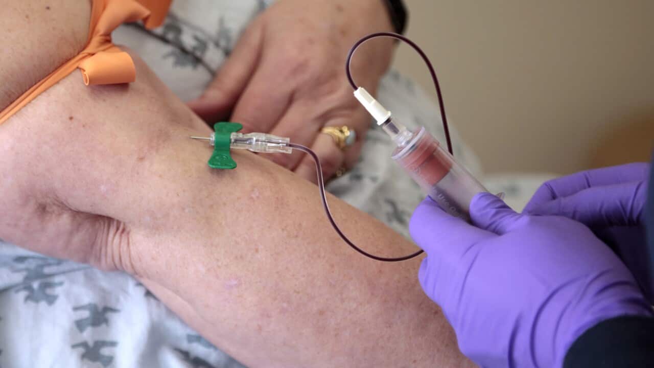 Nearly 100 people a year are being compelled to be tested for HIV in WA. 