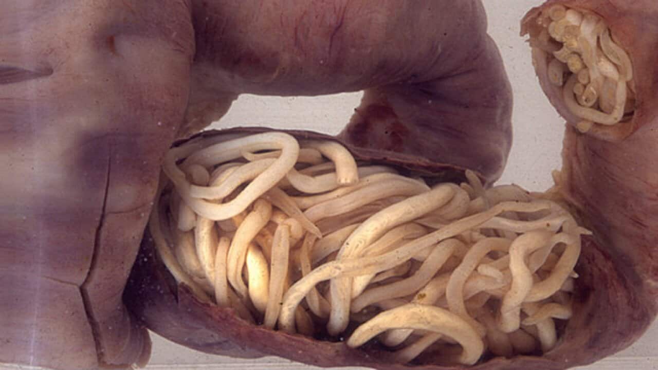Piece of intestine blocked by worms