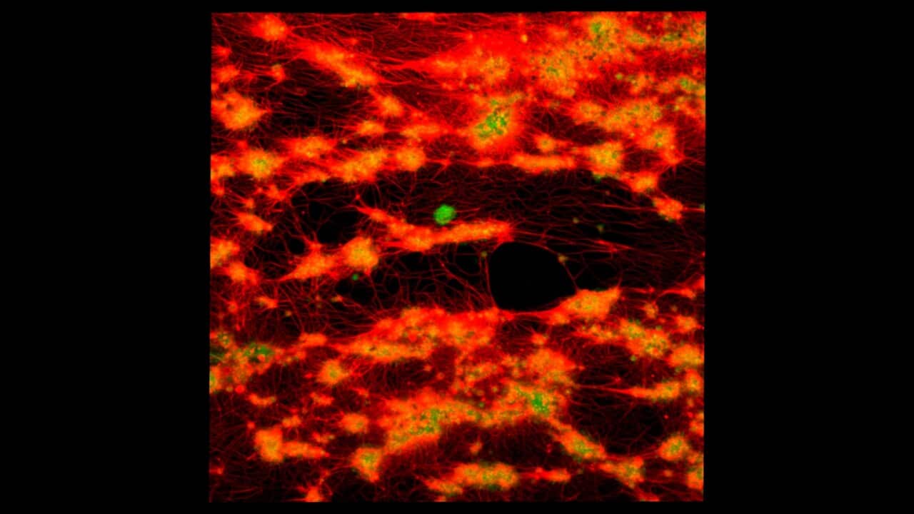 Human Blood Clot