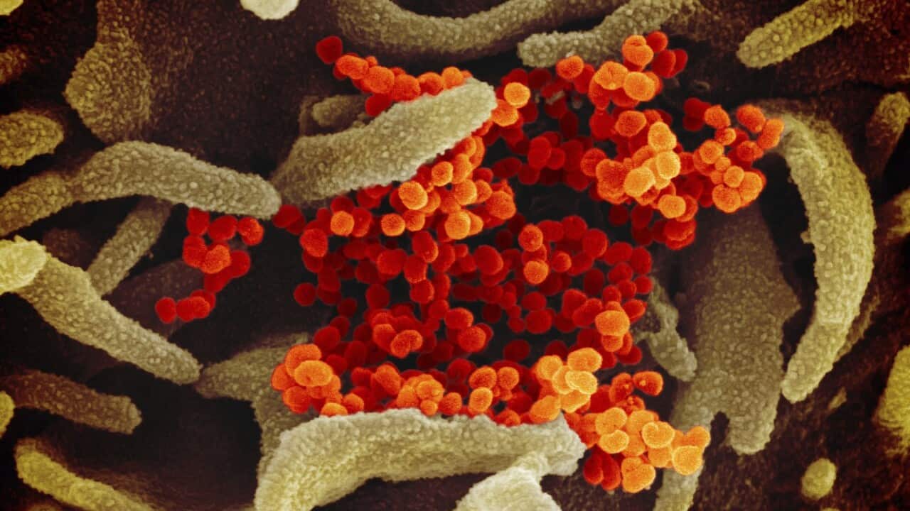A microscope image of novel coronavirus (AAP)