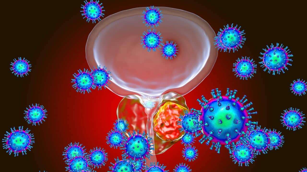 Prostate cancer