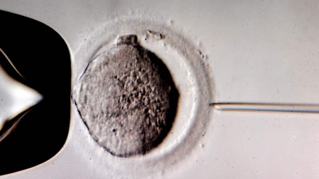 A monitor shows the microinjection of sperm into an egg cell using a microscope at the in vitro fertilization clinic