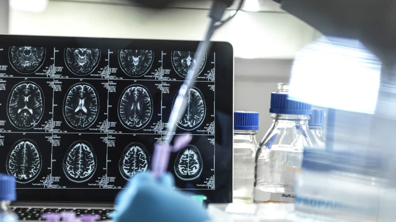 Alzheimers and dementia research