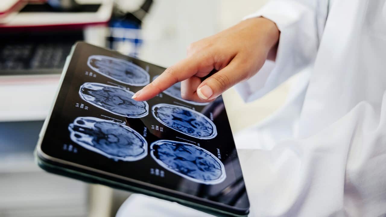 Close-up Shot of a Doctor's Hand Pointing on Brain Scan Images on Digital Tablet