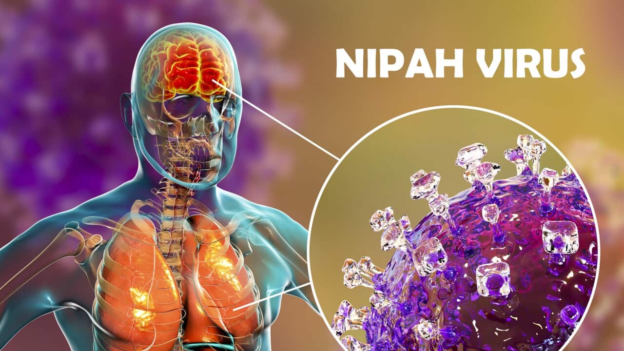 Encephalitis caused by Nipah viruses, illustration