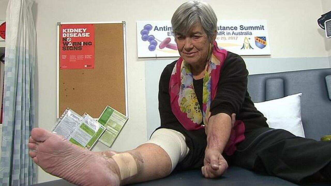 Sandra Hocking with ailing leg