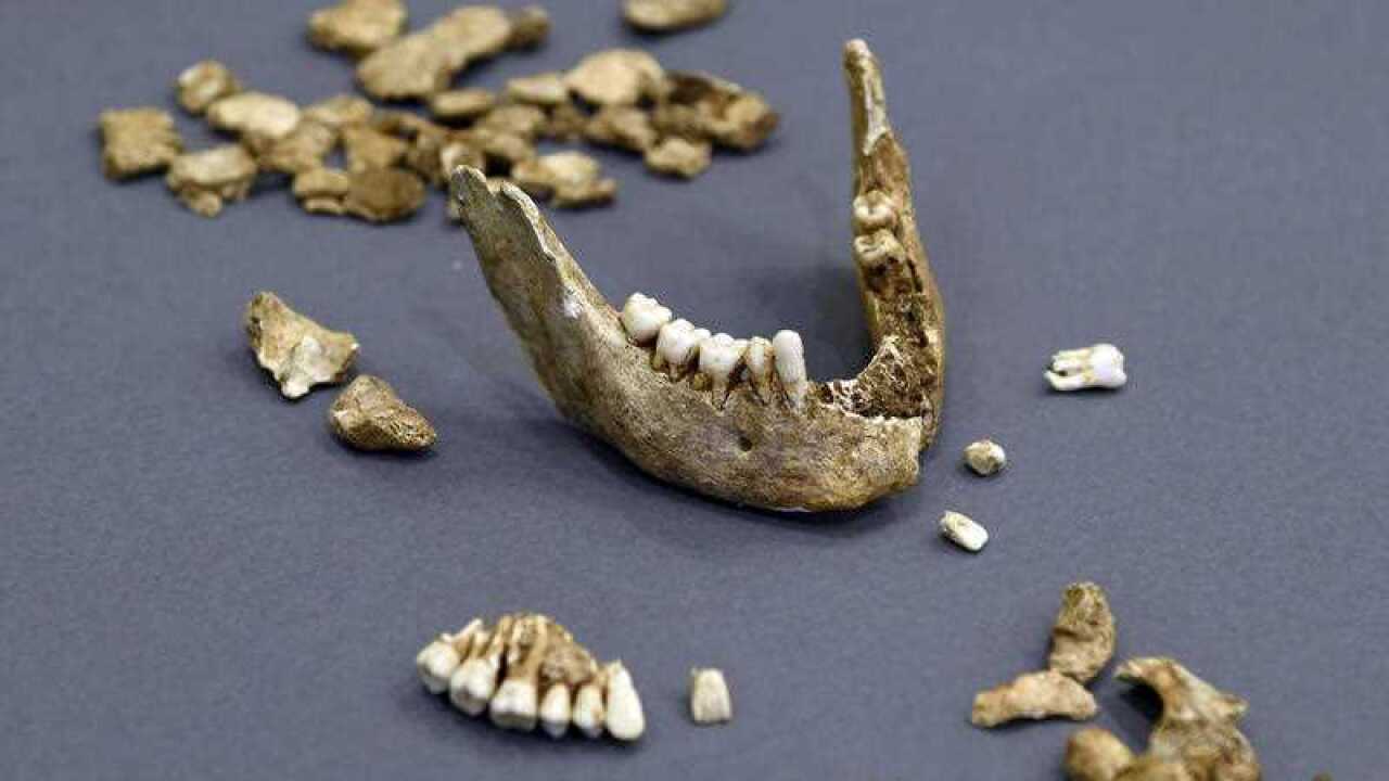 The bone fragments of Capt. William West is displayed at the Smithsonian's National Museum of Natural History