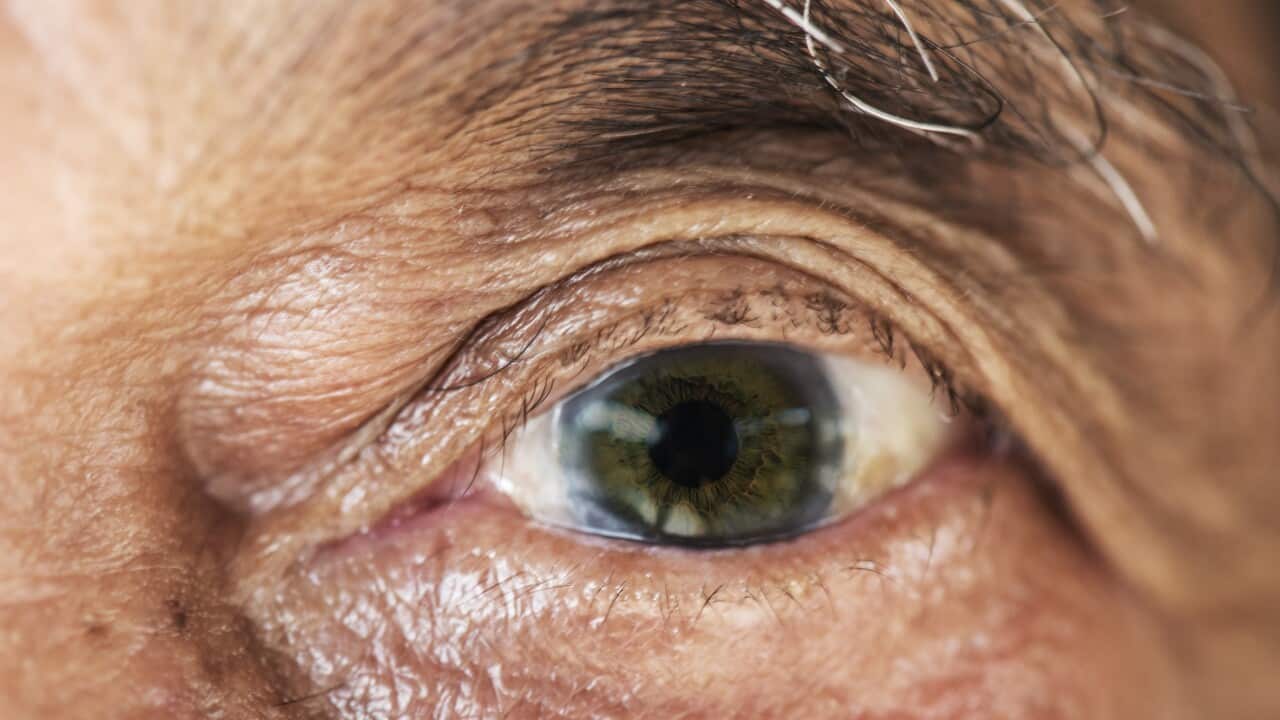 Image for read more article ''