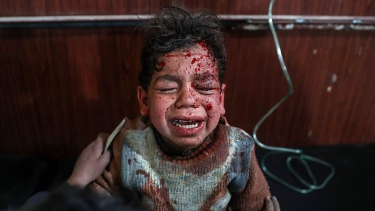 An injured child in Douma, eastern Ghouta, Syria