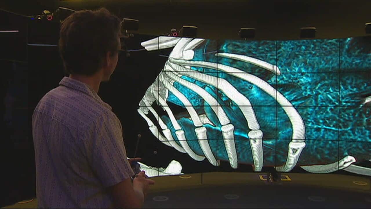 Australian innovation captures 4D lung motion