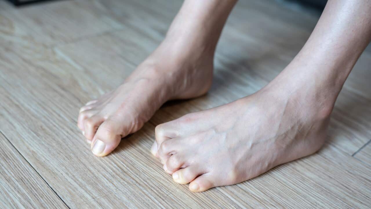 Cropped shot of woman legs having toe spasms.
