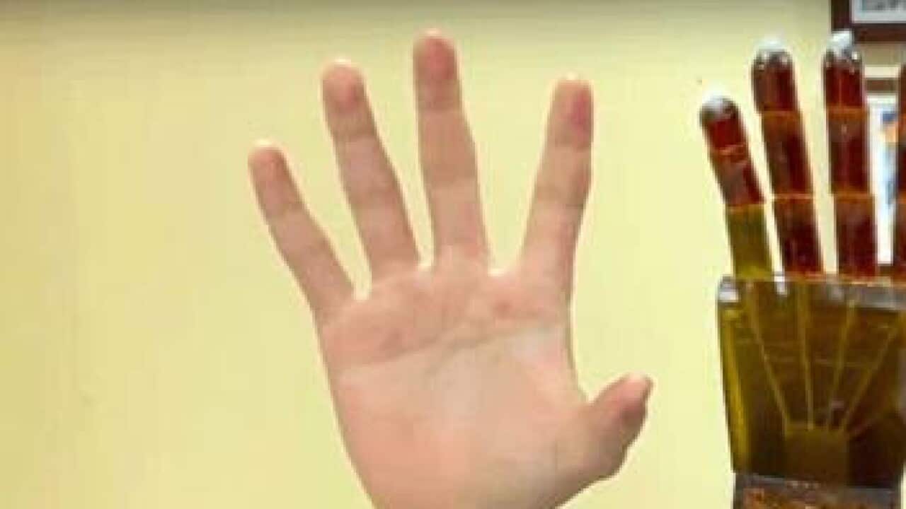 Image for read more article ''