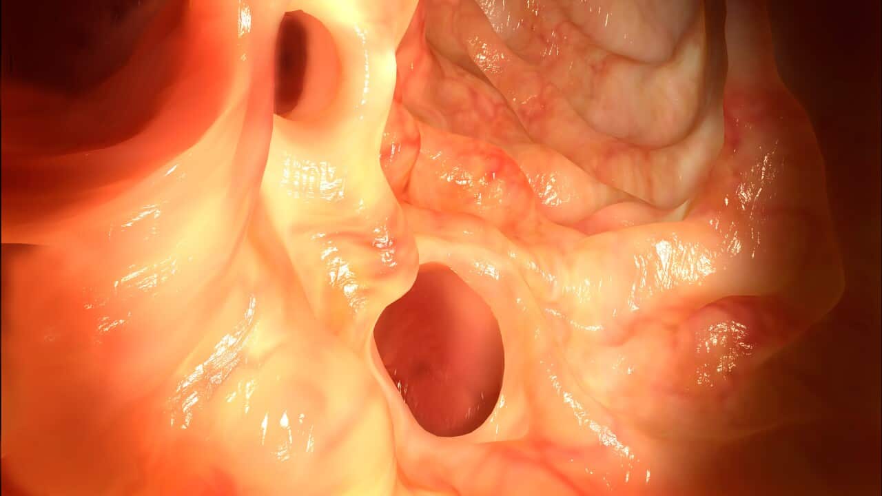 Image for read more article ''