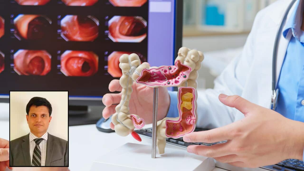 Dr Thushara - Bowel Cancer.jpg