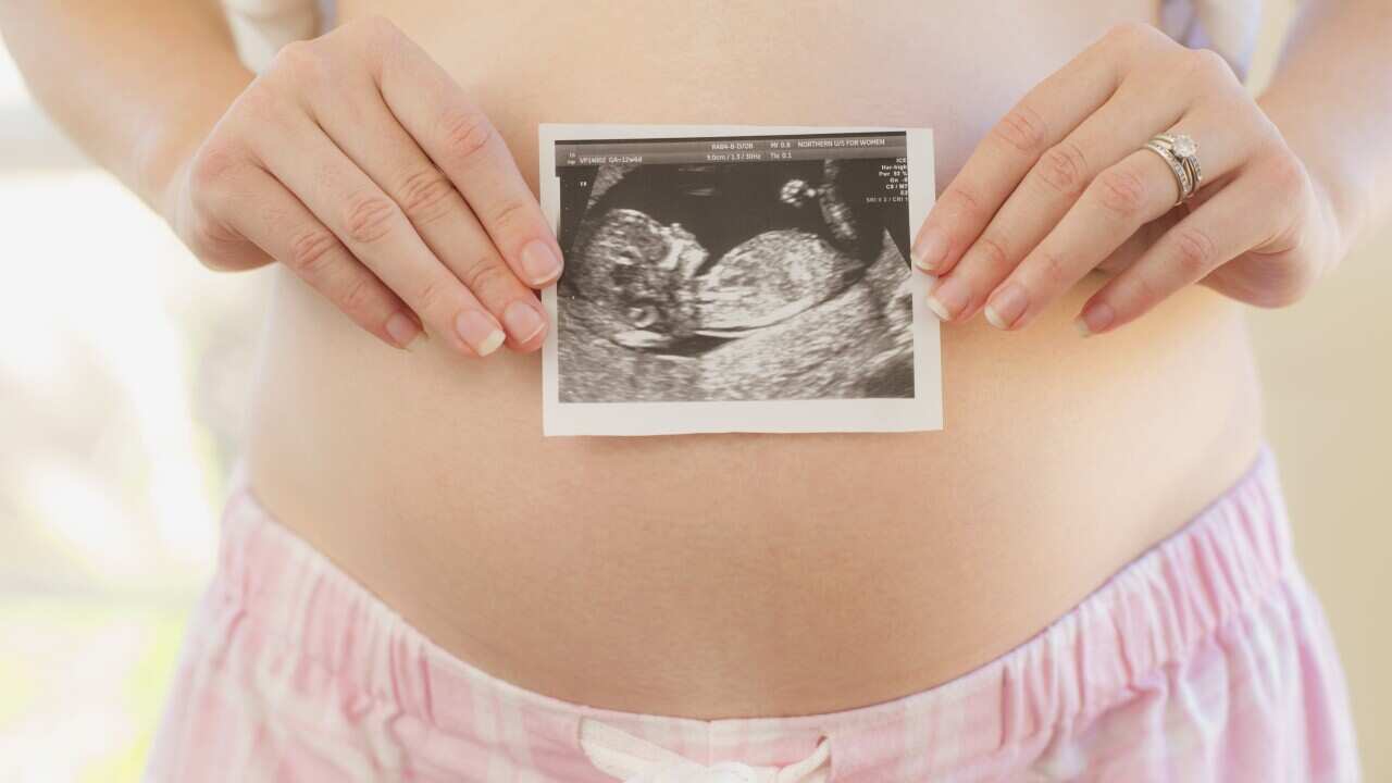 Caucasian woman holding sonogram over pregnant belly