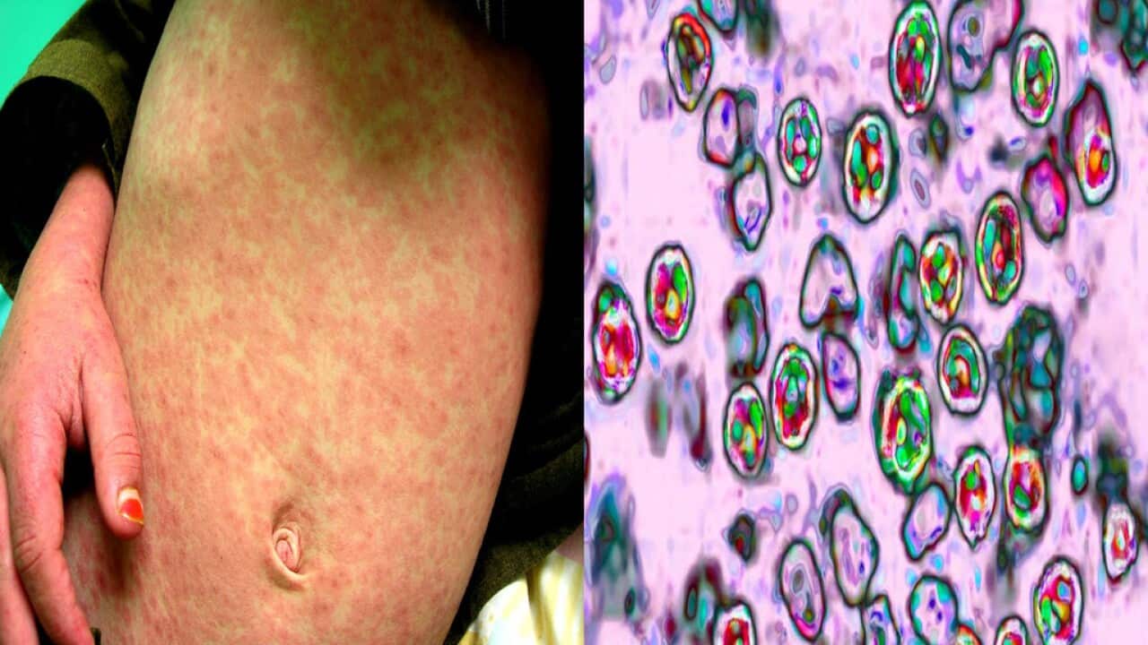 Image for read more article 'READ MORE'