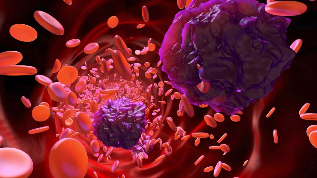 3D rendered Illustration of Leukemia cells in the blood stream