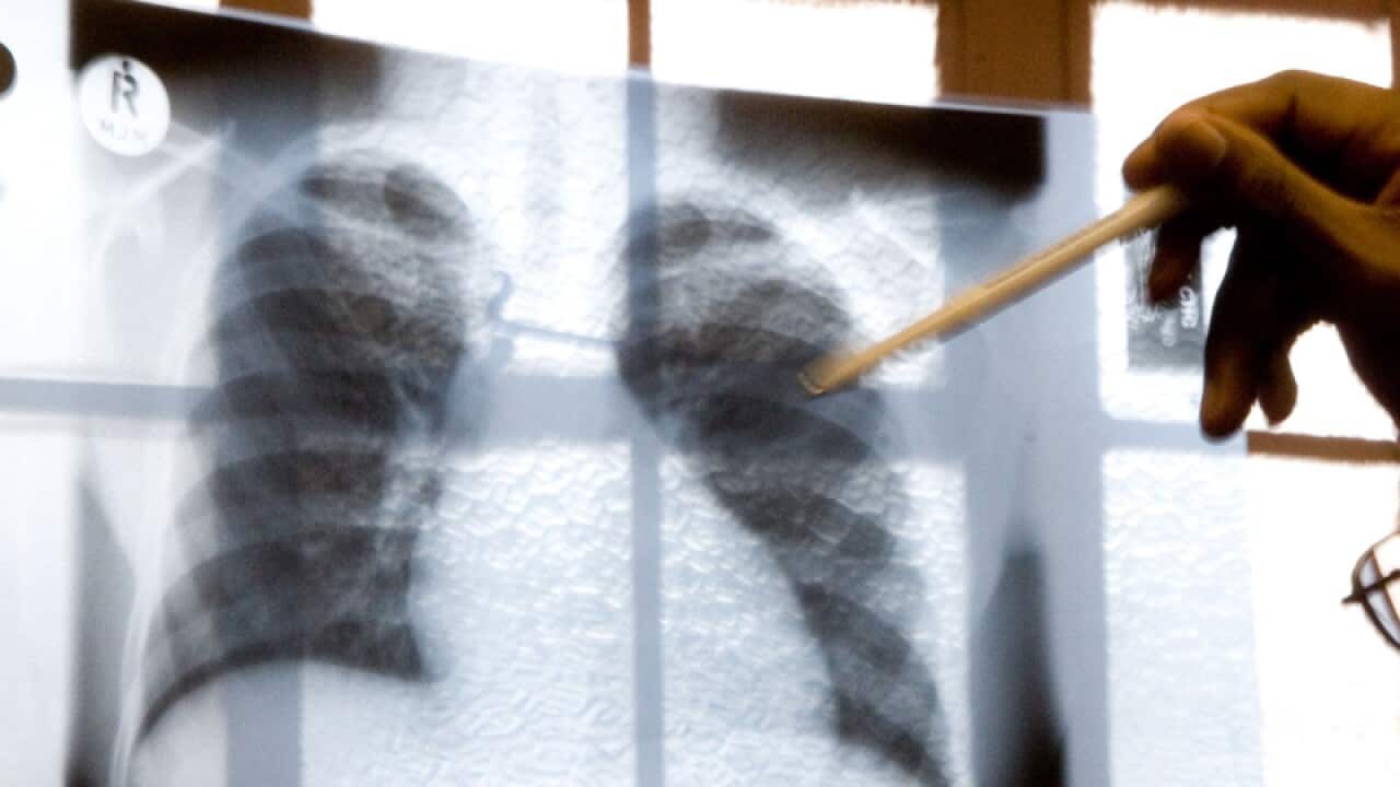 A doctor examines chest X-rays.