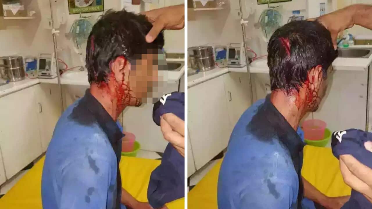 Pakistani refugee who was allegedly assaulted on Nauru