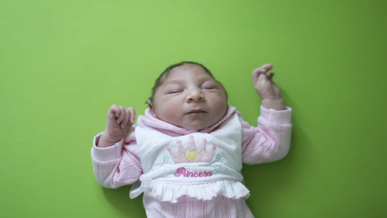 A baby born with microcephaly in Brazil