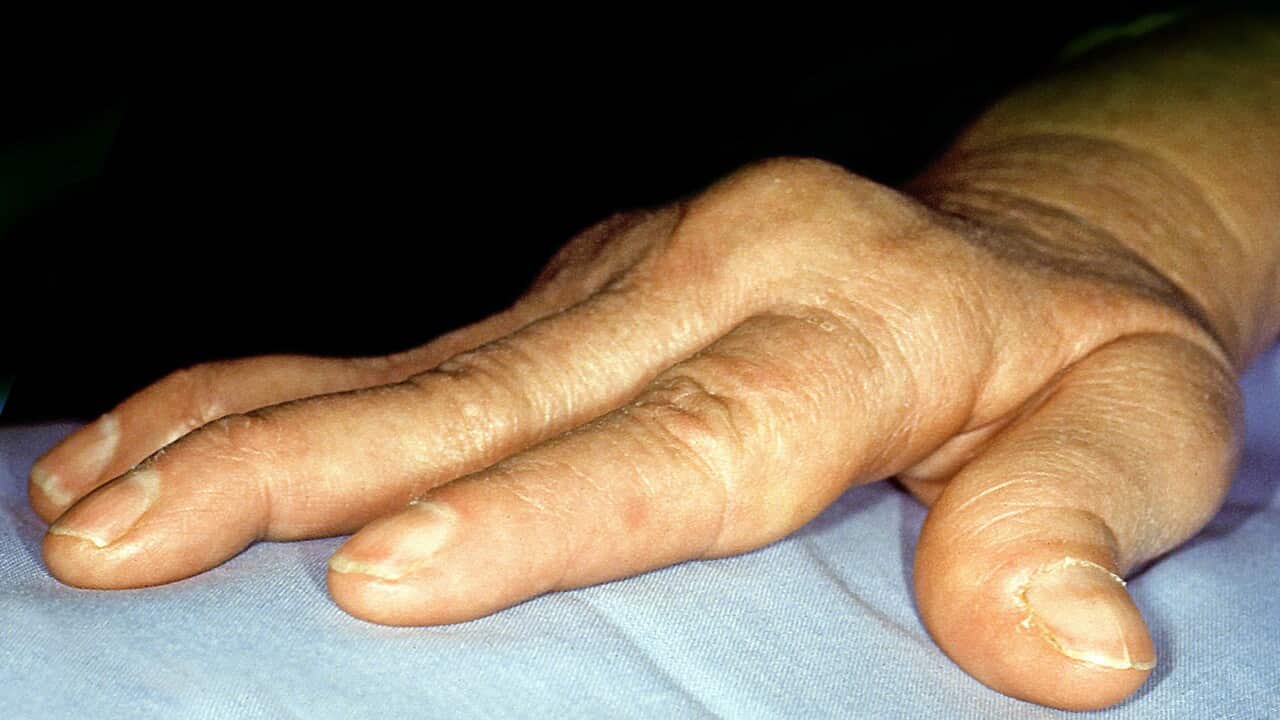 Image for read more article ''