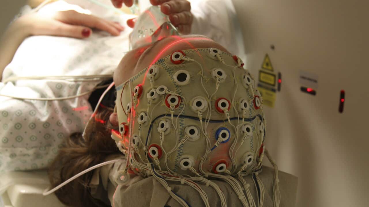 File image of a brain scan.