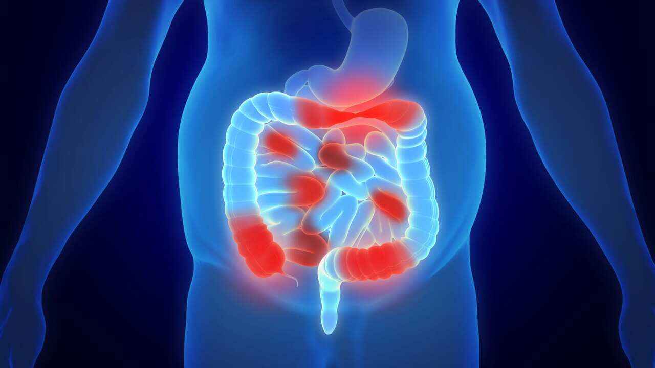 Hope for people suffering from inflammatory bowel disease