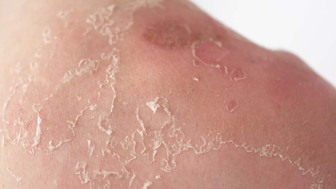 Image for read more article 'READ MORE'