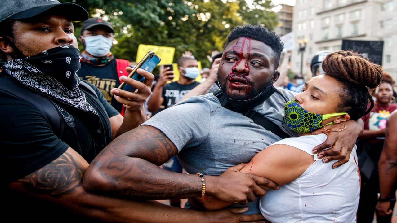 An injured man reacts during scuffles with US Park Police officers during protests over the Minneapolis death of George Floyd.