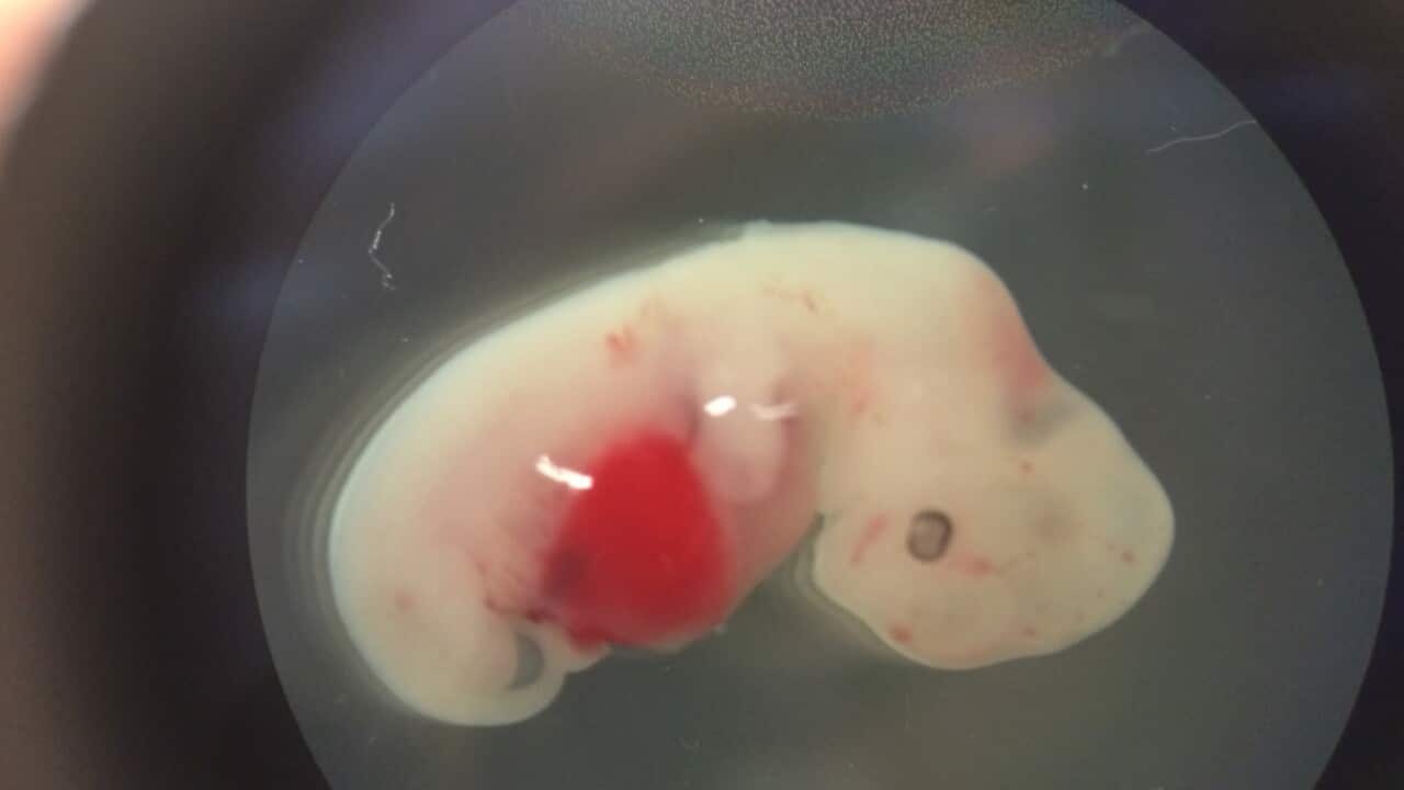 This undated photo provided by the Salk Institute on Jan. 24, 2017 shows a 4-week-old pig embryo which had been injected with human stem cells. 