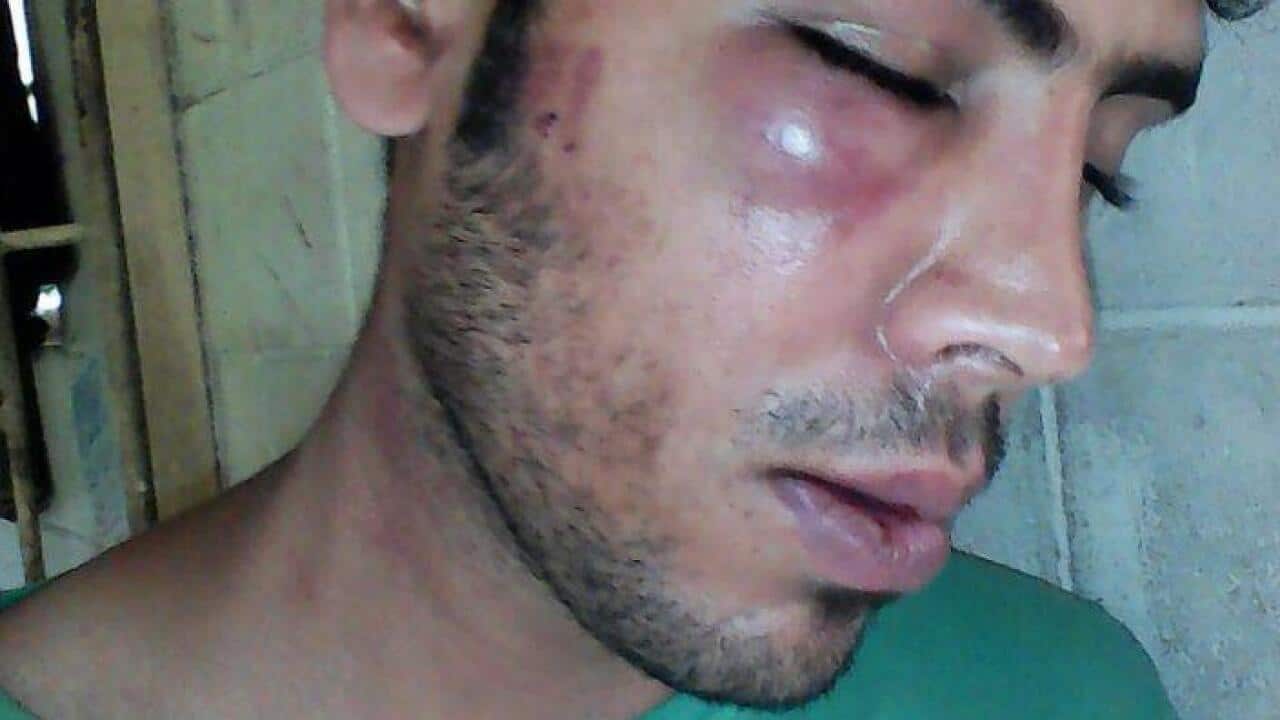 Image for read more article 'Related'