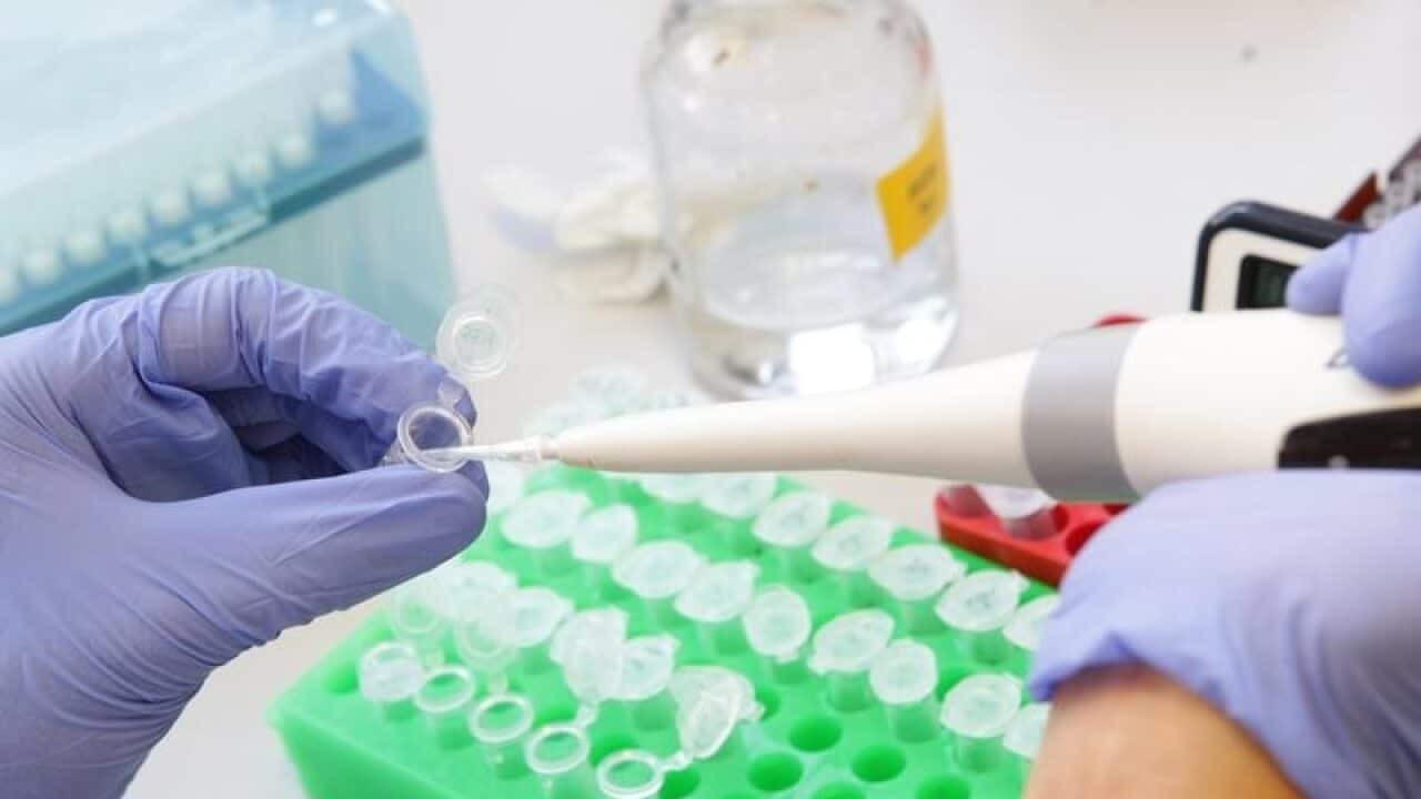 Scientific testing equipment.